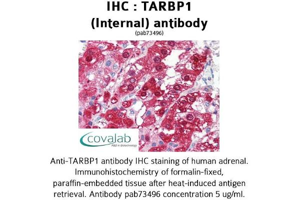 TARBP1 抗体  (Internal Region)