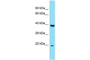 Host: Rabbit Target Name: C7orf50 Sample Type: RPMI-8226 Whole Cell lysates Antibody Dilution: 1. (C7orf50 抗体  (N-Term))