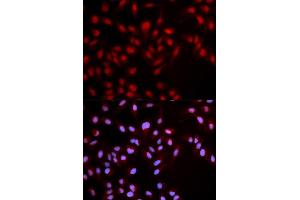 Immunofluorescence (IF) image for anti-Met Proto-Oncogene (MET) (pTyr1349) antibody (ABIN1870436) (c-MET 抗体  (pTyr1349))