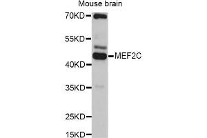 Western blot analysis of extracts of mouse brain, using MEF2C antibody. (MEF2C 抗体)