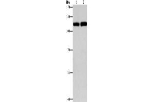 Western Blotting (WB) image for anti-Toll-Like Receptor 3 (TLR3) antibody (ABIN2421026) (TLR3 抗体)