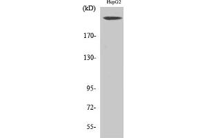 Western Blot analysis of various cells using Neurofibromin Polyclonal Antibody. (Neurofibromin 1 抗体  (AA 1520-1600))