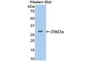 Western Blotting (WB) image for anti-Cyclin D1 (CCND1) (AA 31-295) antibody (ABIN1077956) (Cyclin D1 抗体  (AA 31-295))