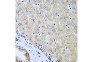 Immunohistochemistry of paraffin-embedded human liver using IL5 antibody (ABIN5975164) at dilution of 1/100 (40x lens). (IL-5 抗体)