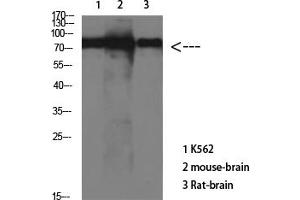 Western Blot analysis of various cells using Antibody diluted at 1:1000. (tau 抗体)