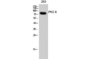 Western Blotting (WB) image for anti-Protein Kinase C, theta (PRKCQ) (Thr319) antibody (ABIN3176929) (PKC theta 抗体  (Thr319))