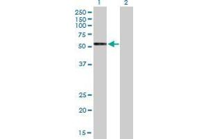 Lane 1: GPRC5C transfected lysate ( 49. (GPRC5C 293T Cell Transient Overexpression Lysate(Denatured))