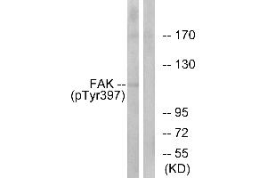 Western blot analysis of extracts from 293cells, treated with EGF (200ng/ml, 30mins), using FAK (Phospho-Tyr397) antibody. (FAK 抗体  (pTyr397))