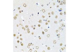 Immunohistochemistry of paraffin-embedded rat brain using RAB3IP antibody. (RAB3IP 抗体  (AA 1-150))