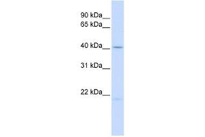 Ectodysplasin A antibody used at 1 ug/ml to detect target protein. (Ectodysplasin A 抗体  (Middle Region))