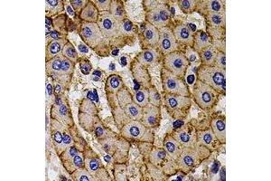 Immunohistochemical analysis of CCR5 staining in human liver formalin fixed paraffin embedded tissue section. (CCR5 抗体)