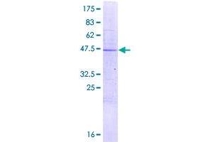 Image no. 1 for Lysozyme G-Like 1 (LYG1) (AA 1-194) protein (GST tag) (ABIN1309921) (LYG1 Protein (AA 1-194) (GST tag))