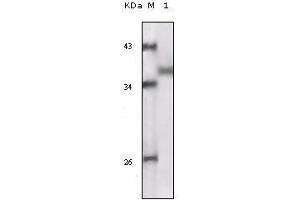 Western blot analysis using RSK1 mouse mAb against truncated RSK1 recombinant protein. (RPS6KA1 抗体)