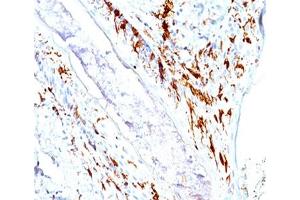 IHC testing of human skin stained with CD1a antibody cocktail (O10 + C1A/711). (CD1a 抗体)