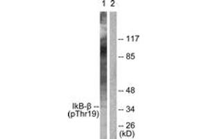Western blot analysis of extracts from 293 cells treated with TNF-a 20ng/ml 30', using IkappaB-beta (Phospho-Thr19) Antibody. (NFKBIB 抗体  (pThr19))