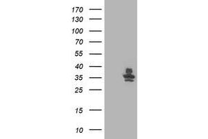 Western Blotting (WB) image for anti-Retinaldehyde Binding Protein 1 (RLBP1) antibody (ABIN1497624) (RLBP1 抗体)