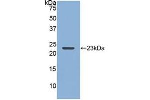 Detection of Recombinant MMP12, Rabbit using Polyclonal Antibody to Matrix Metalloproteinase 12 (MMP12) (MMP12 抗体  (AA 286-464))