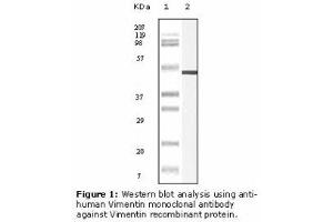 Image no. 2 for anti-Vimentin (VIM) antibody (ABIN232124) (Vimentin 抗体)