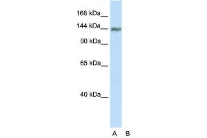 Western Blot showing TIMELESS antibody used at a concentration of 1-2 ug/ml to detect its target protein. (TIMELESS 抗体  (C-Term))