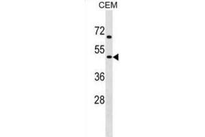 Western Blotting (WB) image for anti-Cholinergic Receptor, Nicotinic, gamma (CHRNG) antibody (ABIN2999214) (CHRNG 抗体)