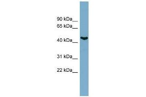 IRX6 antibody used at 0. (IRX6 抗体  (N-Term))