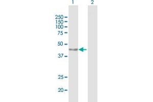 Western Blot analysis of PARP15 expression in transfected 293T cell line by PARP15 MaxPab polyclonal antibody. (PARP15 抗体  (AA 1-444))