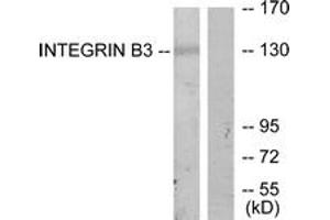 Western blot analysis of extracts from HepG2 cells, using Integrin beta3 (Ab-773) Antibody. (Integrin beta 3 抗体  (AA 731-780))