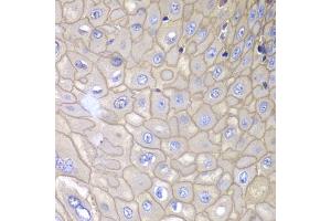 Immunohistochemistry of paraffin-embedded human esophagus using ANXA1 antibody (ABIN5970468) at dilution of 1/100 (40x lens). (Annexin a1 抗体)