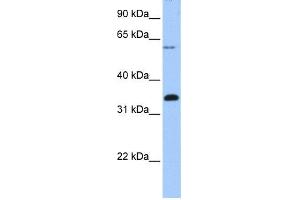 WB Suggested Anti-FBXO16 Antibody Titration: 0. (FBXO16 抗体  (C-Term))