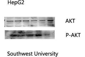 Western Blot (WB) analysis: Please contact us for more details. (AKT1 抗体  (Internal Region))