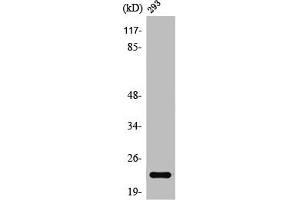 Western Blot analysis of 293 cells using Rab 35 Polyclonal Antibody (RAB35 抗体  (Internal Region))