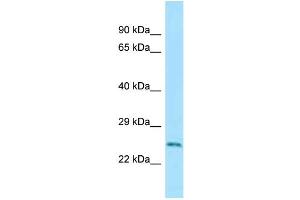 WB Suggested Anti-Rab5a Antibody Titration: 1. (RAB5 抗体  (C-Term))