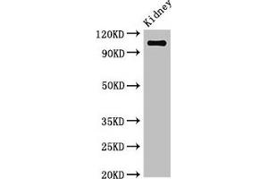 Western Blot Positive WB detected in: Mouse kidney tissue All lanes: ANPEP antibody at 3. (CD13 抗体  (AA 34-219))