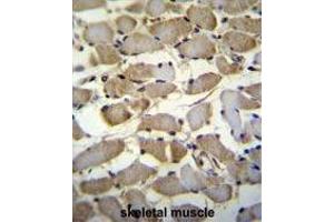 ZMYND17 Antibody (C-term) immunohistochemistry analysis in formalin fixed and paraffin embedded human skeletal muscle followed by peroxidase conjugation of the secondary antibody and DAB staining. (ZMYND17 抗体  (C-Term))