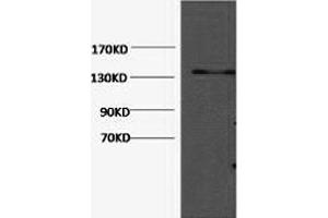Western Blotting (WB) image for anti-Collagen, Type III, alpha 1 (COL3A1) antibody (ABIN5959045) (COL3A1 抗体)