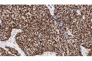 Immunohistochemistry (IHC) image for anti-NK2 Homeobox 1 (NKX2-1) (N-Term) antibody (ABIN7538942) (NKX2-1 抗体  (N-Term))