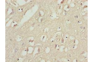 Immunohistochemistry of paraffin-embedded human brain tissue using ABIN7159778 at dilution of 1:100 (MAP1LC3A 抗体  (AA 1-120))