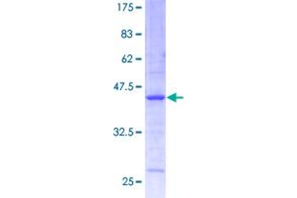 CST3 Protein (AA 1-146) (GST tag)