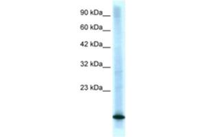 Western Blotting (WB) image for anti-Cyclin-Dependent Kinase Inhibitor 2B (p15, Inhibits CDK4) (CDKN2B) antibody (ABIN2463682) (CDKN2B 抗体)