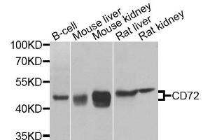 Western blot analysis of extracts of various cell lines, using CD72 antibody (ABIN6003638) at 1/1000 dilution. (CD72 抗体)