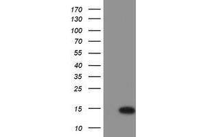 Western Blotting (WB) image for anti-Chromosome 17 Open Reading Frame 37 (C17orf37) antibody (ABIN1501778) (C17orf37 抗体)