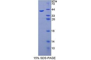 SDS-PAGE analysis of Human SYT1 Protein. (SYT1 蛋白)