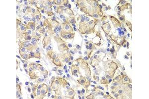 Immunohistochemistry of paraffin-embedded Human stomach using Lyn Polyclonal Antibody at dilution of 1:100 (40x lens). (LYN 抗体)