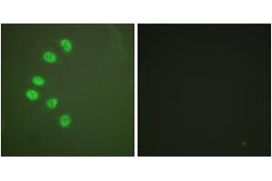 Immunofluorescence (IF) image for anti-Progesterone Receptor (PGR) (AA 261-310) antibody (ABIN2888697) (Progesterone Receptor 抗体  (AA 261-310))