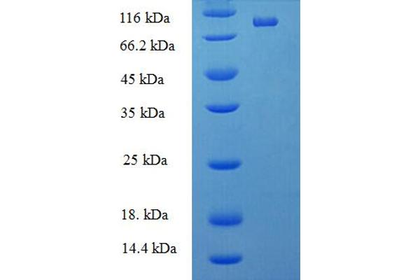 DDX19A Protein (AA 1-478, full length) (His-SUMO Tag)