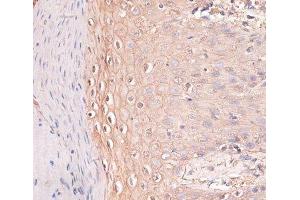 Immunohistochemistry of paraffin-embedded Human skin using CDH3 Polyclonal Antibody at dilution of 1:100 (40x lens). (P-Cadherin 抗体)