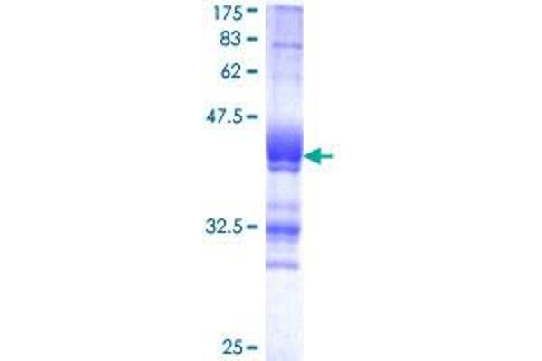 GLUL Protein (AA 274-373) (GST tag)