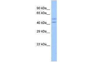Host:  Rabbit  Target Name:  ZNF679  Sample Type:  Fetal Heart lysates  Antibody Dilution:  1. (ZNF679 抗体  (N-Term))