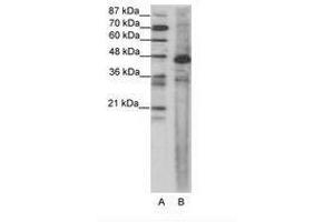 Image no. 1 for anti-Serum Response Factor (SRF) (AA 120-169) antibody (ABIN202686) (SRF 抗体  (AA 120-169))