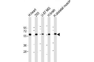 All lanes : Anti-ENTPD2 Antibody at 1:1000 dilution Lane 1: human heart lysate Lane 2: 293 whole cell lysate Lane 3: U-87 MG whole cell lysate Lane 4: human brain lysate Lane 5: human skeletal muscle lysate Lysates/proteins at 20 μg per lane. (ENTPD2 抗体  (N-Term))